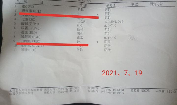 吃锌硒宝小便很黄(补锌小便会变黄吗)-硒宝网