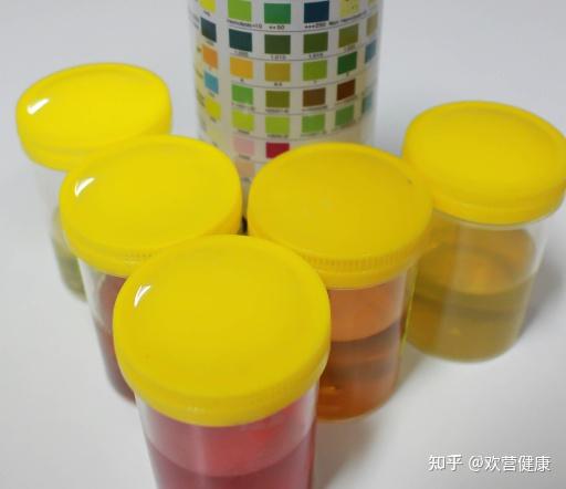 吃锌硒宝小便很黄(锌尿黄)-硒宝网