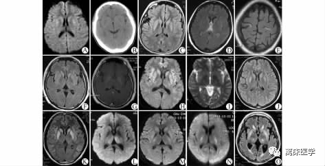 血钠低怎么补（低钠血症补钠补不上去）-硒宝网