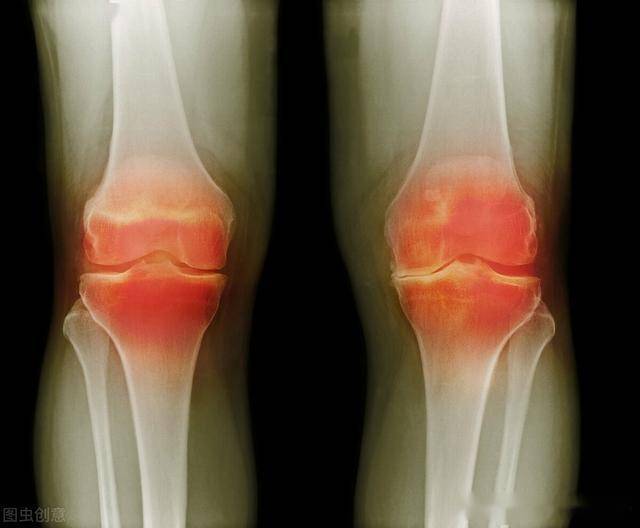 氨糖能补钙吗（补钙氨糖软骨素好还是钙片好）-硒宝网