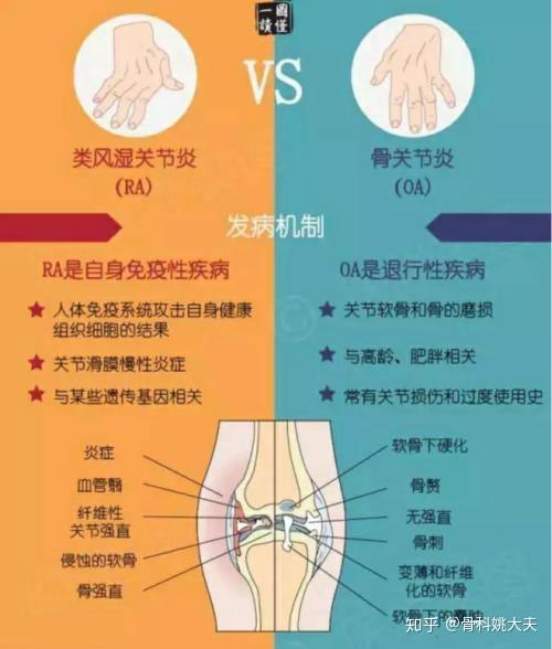 氨糖能补钙吗（补钙氨糖哪种效果好）-硒宝网