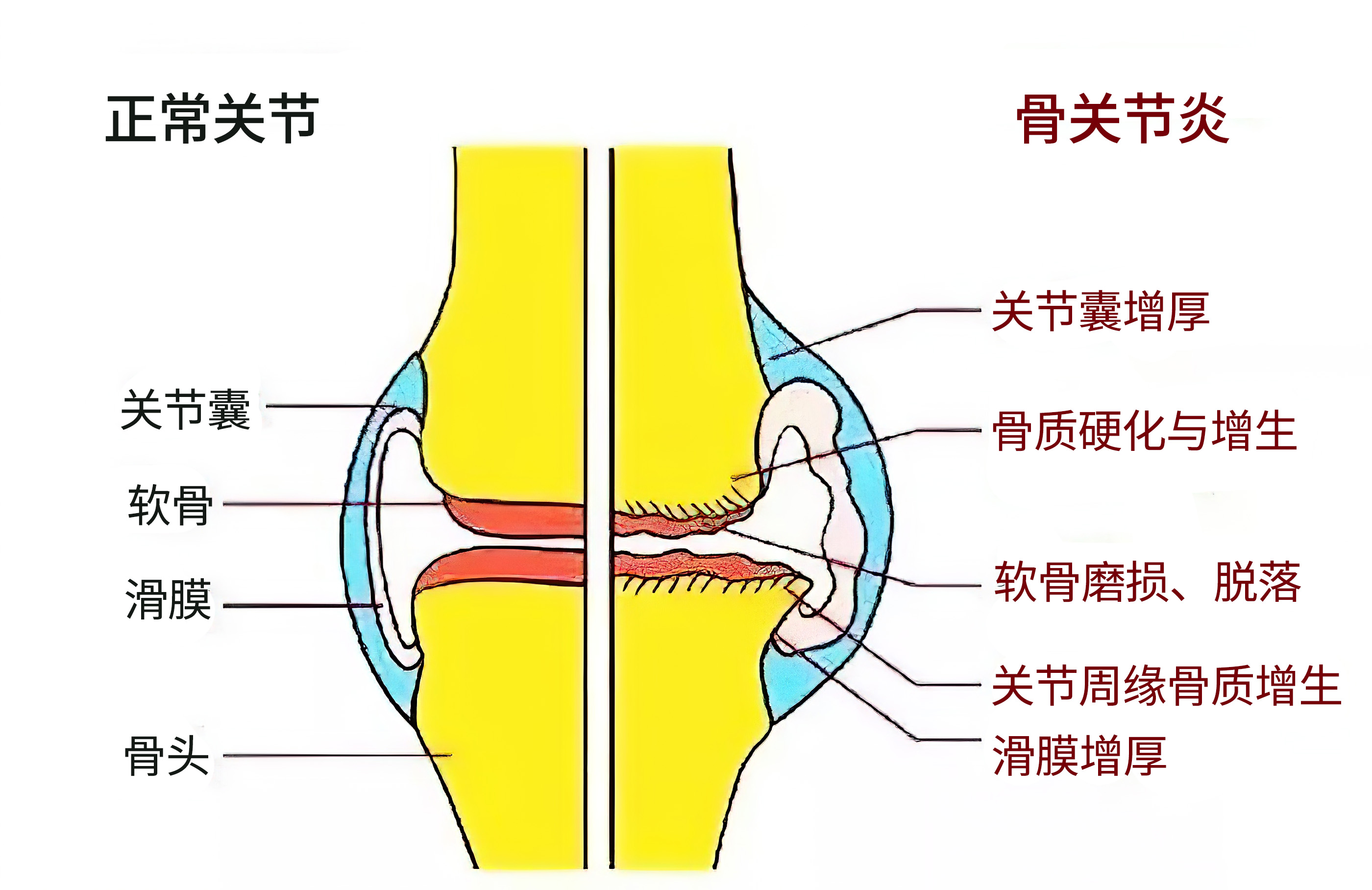 氨糖能补钙吗（补钙氨糖哪种效果好）-硒宝网