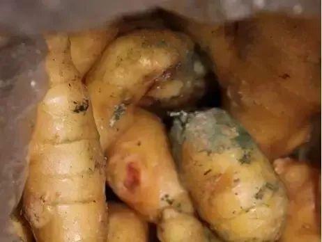 锌硒宝能止孕吐吗（锌硒宝孕妇）-硒宝网