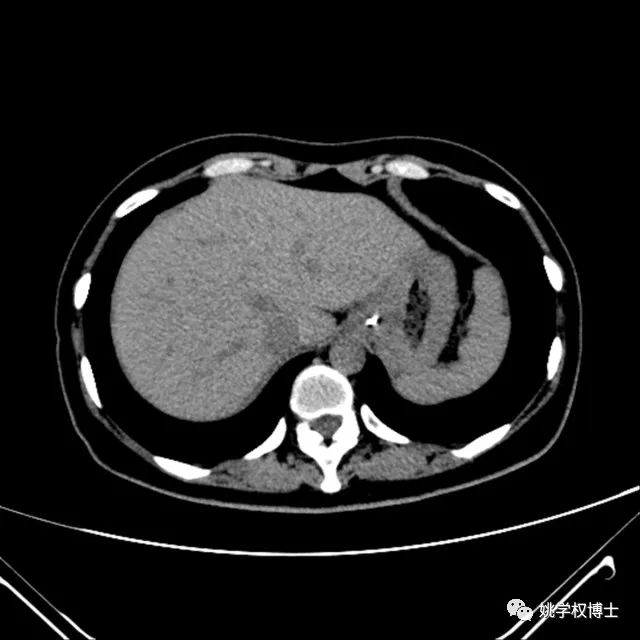 补铁过量的症状(过量症状补铁有用吗)-硒宝网