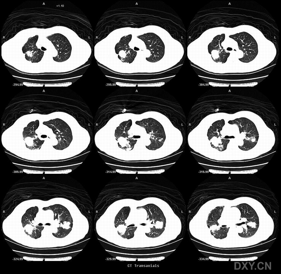 补铁过量的症状(过量症状补铁有用吗)-硒宝网