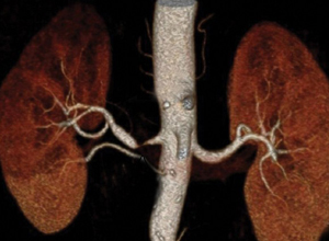 锌硒宝片会过敏吗(吃锌硒宝片过敏怎么办)-硒宝网