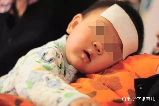 身体缺少微量元素的表现（缺少微量元素的表现）-硒宝网