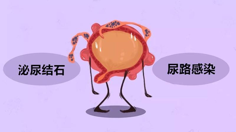 有肾结石怎么补钙(肾结石补钙有副作用吗)-硒宝网