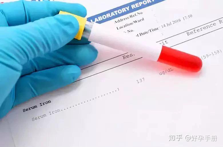 孕妇吃什么补铁快（孕妇吃补铁片的最佳时间）-硒宝网