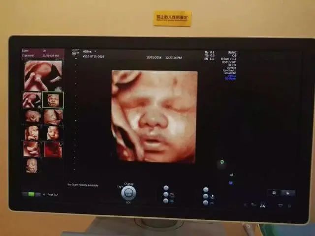 锌硒宝能不能补锌(锌硒宝可以吃吗)-硒宝网