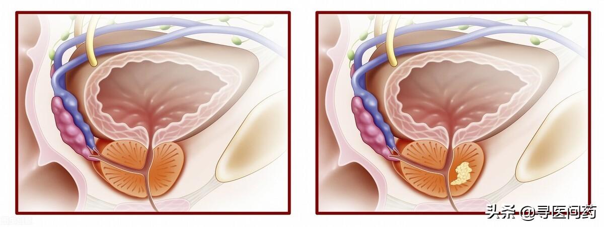 锌硒宝治疗弱精症（锌硒宝生精吗）-硒宝网