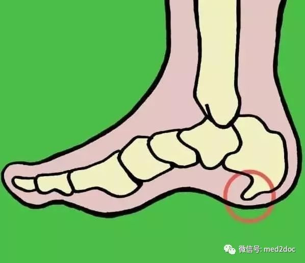 骨刺可以补钙吗（补钙骨刺可以长高吗）-硒宝网