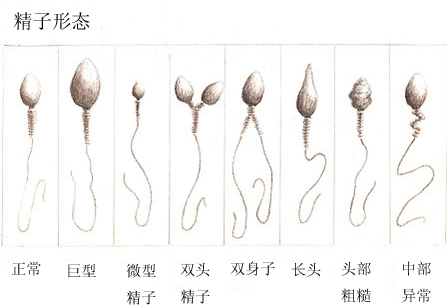锌硒宝的原料是啥(锌硒宝是保健品吗)-硒宝网