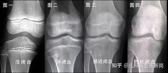 补钙会长胖吗（长得胖的人会不会缺钙）-硒宝网