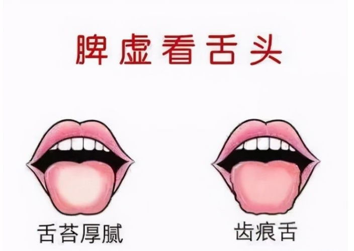 锌硒宝儿童健脾胃(儿童补锌硒宝)-硒宝网