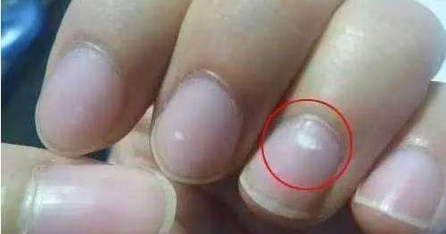 锌硒宝预防癌症吗（锌硒宝治什么）-硒宝网