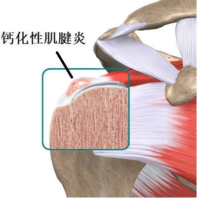 甲状腺手术后为什么要补钙(手术甲状腺补钙要后多久吃饭)-硒宝网