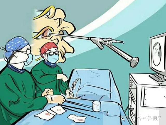 腰椎间盘突出要补钙吗（腰椎盘突出要补钙吗）-硒宝网