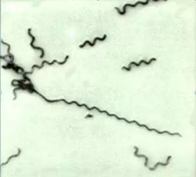 大闸蟹补钙吗（大闸蟹补钙吃什么）-硒宝网