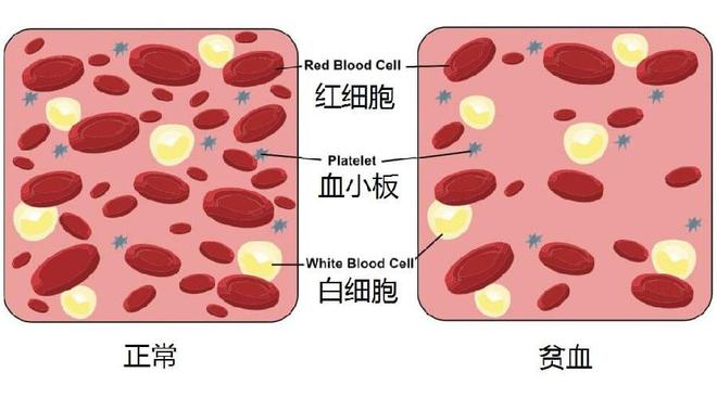 地贫不能补铁(地贫可以补铁)-硒宝网