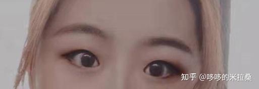 白癜风的人能补硒吗（补硒能预防什么疾?。?硒宝网