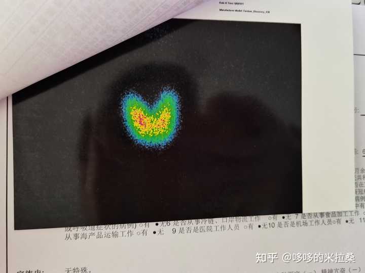 白癜风的人能补硒吗（补硒能预防什么疾?。?硒宝网