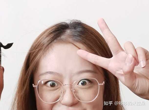 白癜风的人能补硒吗（补硒能预防什么疾?。?硒宝网