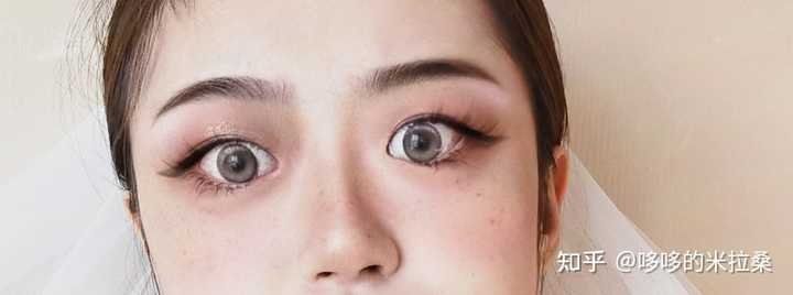 白癜风的人能补硒吗（补硒能预防什么疾?。?硒宝网