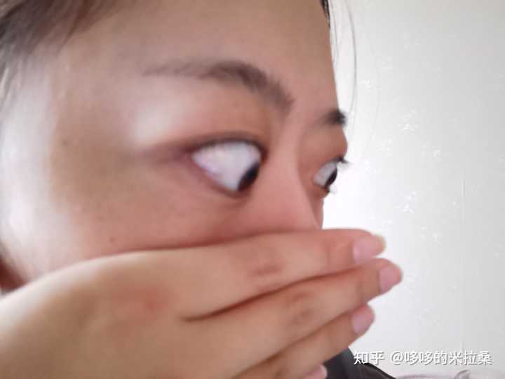 白癜风的人能补硒吗（补硒能预防什么疾?。?硒宝网