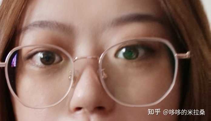 白癜风的人能补硒吗（补硒能预防什么疾病）-硒宝网