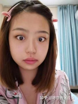 白癜风的人能补硒吗（补硒能预防什么疾?。?硒宝网