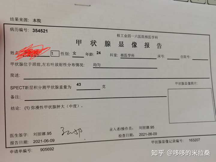 白癜风的人能补硒吗（补硒能预防什么疾?。?硒宝网