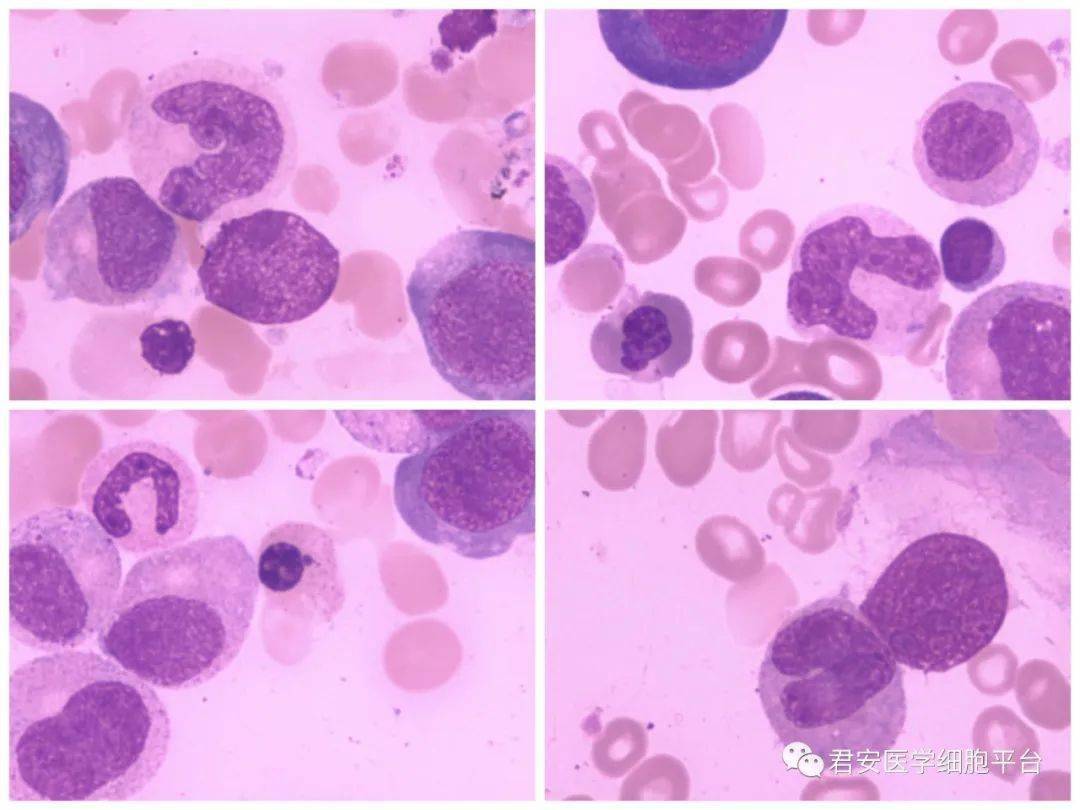 补铁针剂有什么副作用(副作用针剂补铁有用吗)-硒宝网
