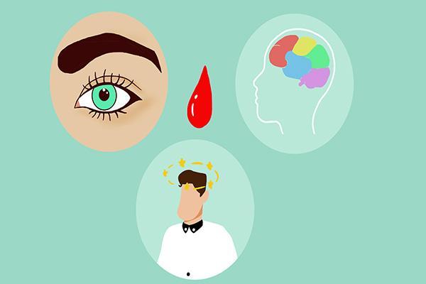 口服补铁（口服补铁的注意事项有哪些）-硒宝网