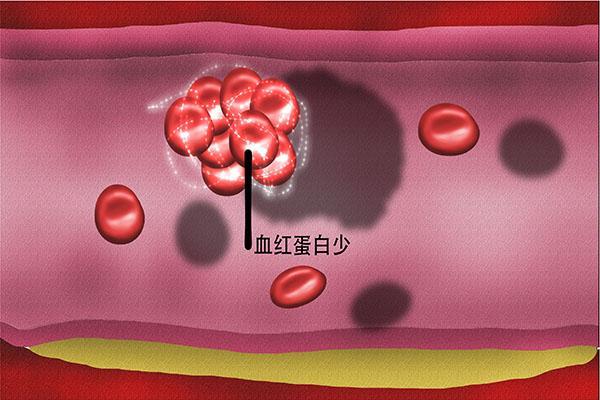 口服补铁（口服补铁的注意事项有哪些）-硒宝网