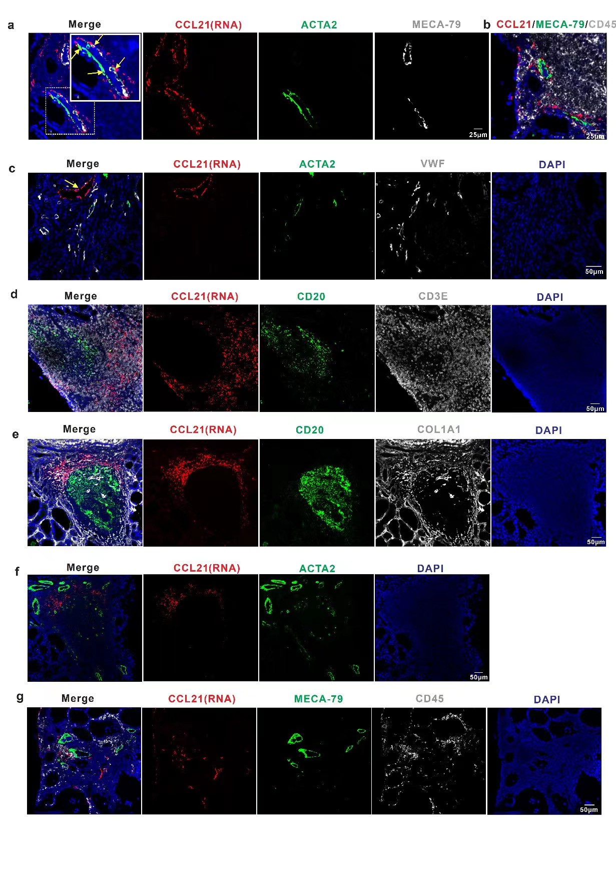 桥本甲状腺开补硒药(桥本氏甲状腺每天补多少硒)-硒宝网
