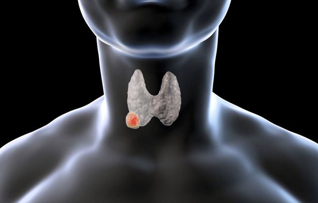 桥本甲状腺开补硒药(桥本氏甲状腺每天补多少硒)-硒宝网