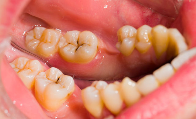 化疗吃补硒缓解呕吐(化疗呕吐吃维生素b6行吗)-硒宝网