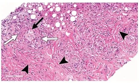 补硒调理乳腺增生吗(调理乳腺增生补硒的药)-硒宝网