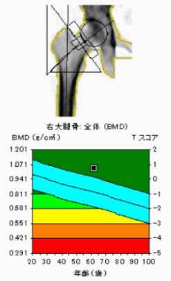 补钙 维生素（哪个维生素补钙）-硒宝网