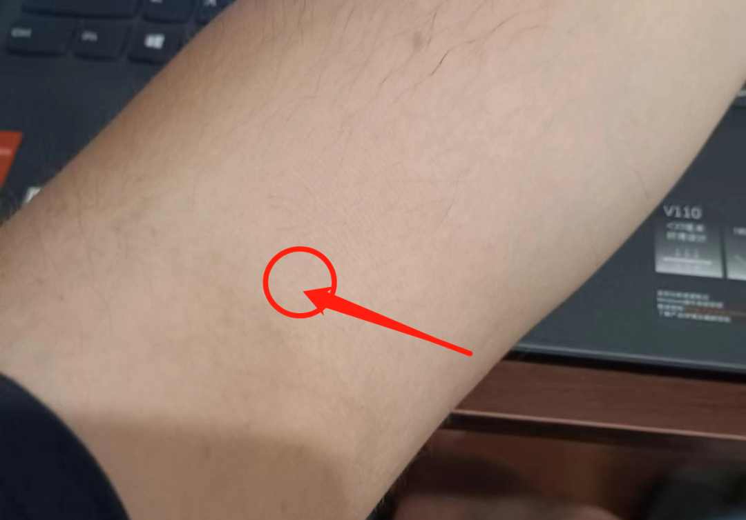 锌硒补多了会嗜睡吗(补锌硒过量的危害)-硒宝网