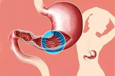 补硒能改善梅毒吗吗（能补改善梅毒硒的药吗）-硒宝网