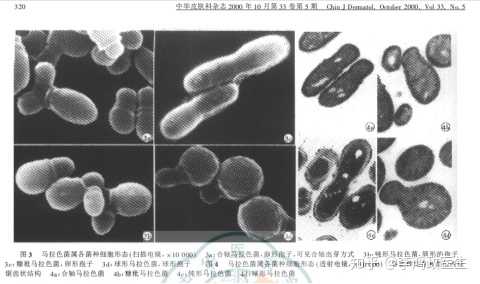 头屑多可以补硒吗女（补硒可以治疗脱发吗）-硒宝网