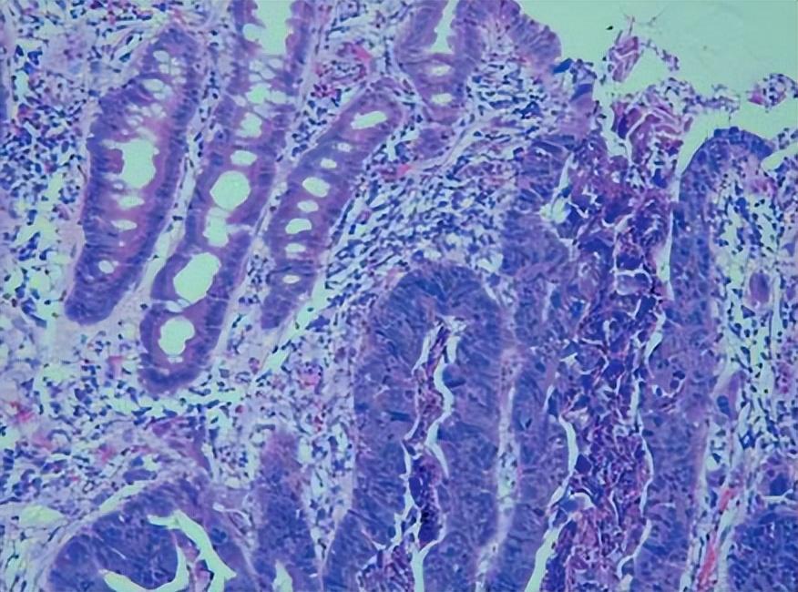 人身体缺硒吃什么补(缺补吃身体硒人会变瘦吗)-硒宝网