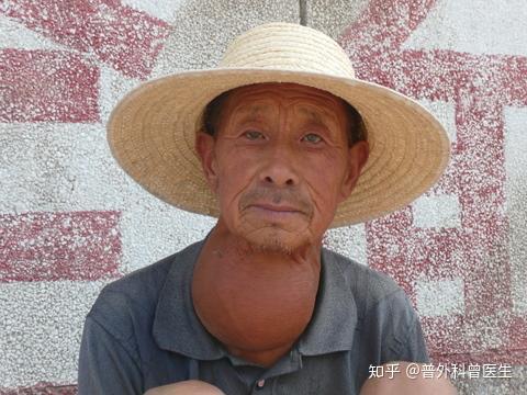 碘元素(碘元素过多会引起什么)-硒宝网