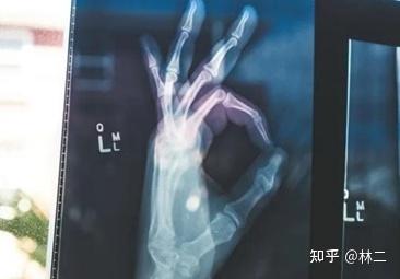 儿童补钙（补钙儿童吃什么好）-硒宝网