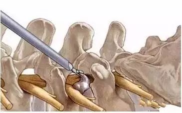 不缺钙可以补钙吗(缺钙能补上吗)-硒宝网