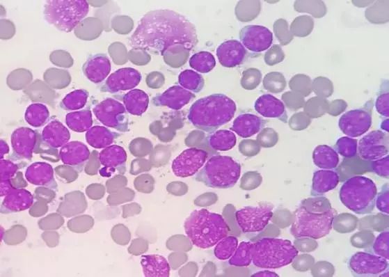 含硒代蛋氨酸的补剂(l硒代蛋氨酸是有机硒吗)-硒宝网