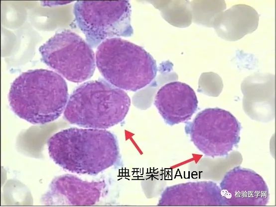 含硒代蛋氨酸的补剂(l硒代蛋氨酸是有机硒吗)-硒宝网