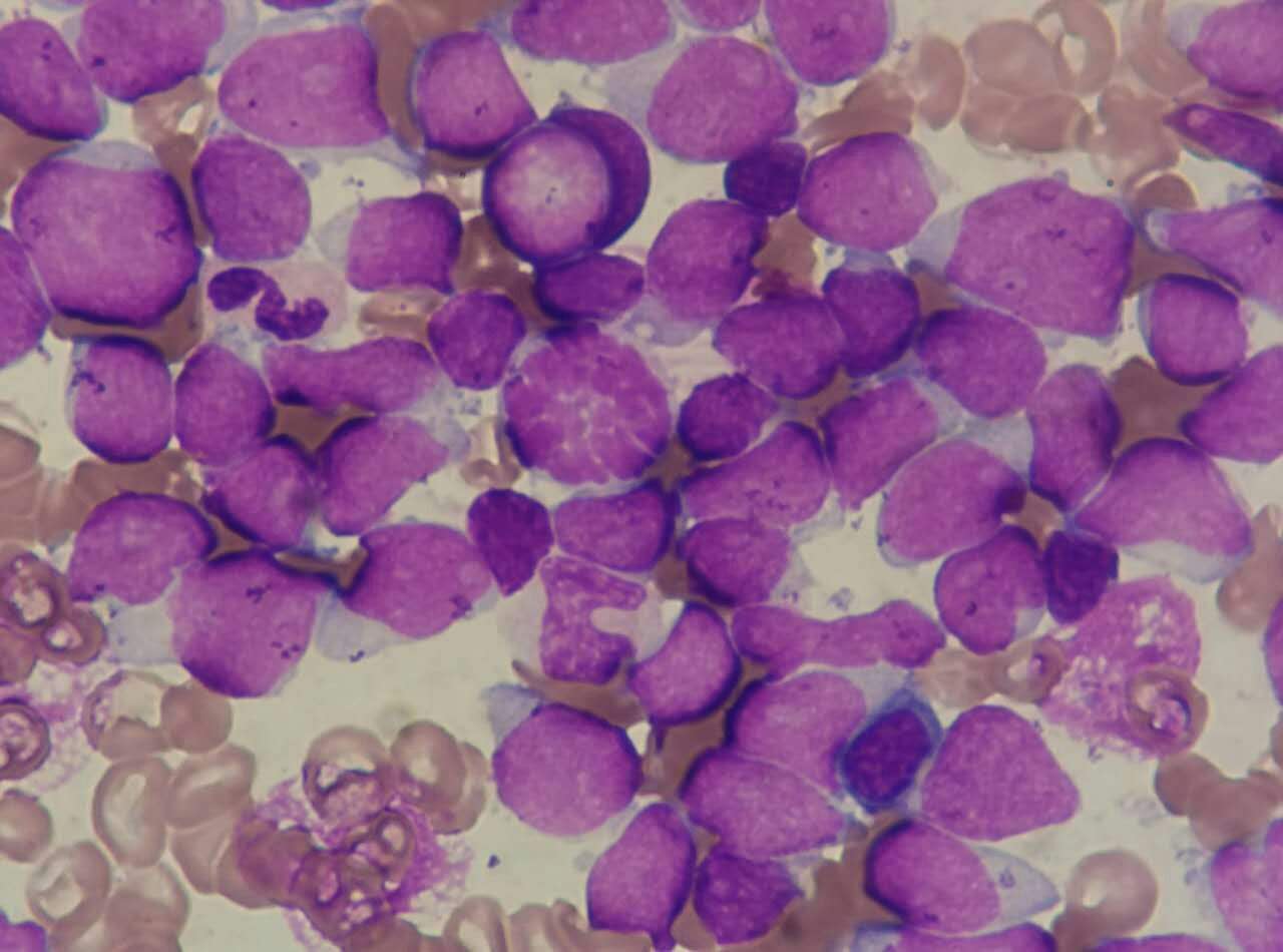 含硒代蛋氨酸的补剂(l硒代蛋氨酸是有机硒吗)-硒宝网